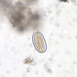 Figure B: Spore of a morel mushroom. Such spores may be confused for helminth eggs, especially hookworm.