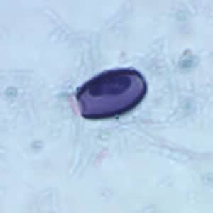 Figure E: Possible pollen grain or algal or fungal spore, similar to the one in Figure B, but in a trichrome-stained stool specimen. Image courtesy of the Washington State Public Health Laboratories.
