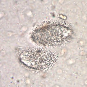 Figure B: Unknown objects in a formalin-concentrated stool specimen. Although these objects do not specifically resemble any parasites of humans, their unique appearance may cause the microscopist to take notice.