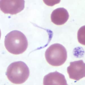 Figure B: Platelet in a thin blood smear. The nature of the platelet gives it the appearance of a trypomastigote of <em>Trypanosoma</em> sp.