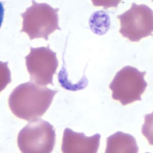 Figure C: Platelets in thin blood smears. The nature of the platelets gives them the appearance of trypomastigotes of <em>Trypanosoma cruzi</em>.