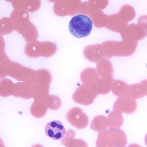Figure F: Neutrophil (lower) and lymphocyte (upper) in a thin blood smear, stained with Giemsa.