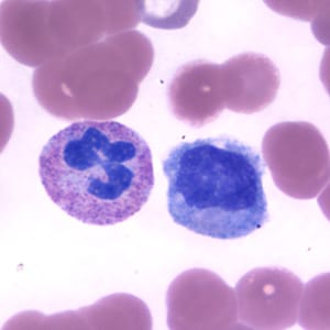 Figure A: Neutrophil (left) and monocyte (right) in a thin blood smear, stained with Giemsa.