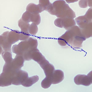 Figure B: Fungal spore of <em>Helicosporium</em> (or related). Such objects are air-borne contaminants in laboratories and may be mistaken for microfilariae in stained blood smears.