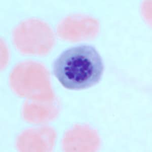 Figure C: Nucleated red blood cell in a thin blood smear, stained with Giemsa. There are several conditions which can cause a premature release of nucleated red blood cells into circulation. Such objects may be confused for schizonts of <em>Plasmodium</em> spp.