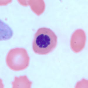Figure D: Nucleated red blood cell in a thin blood smear, stained with Giemsa. There are several conditions which can cause a premature release of nucleated red blood cells into circulation. Such objects may be confused for schizonts of <em>Plasmodium</em> spp.