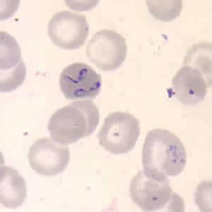 Figure B: <em>Babesia</em> sp. in a thin blood smear stained with Giemsa.