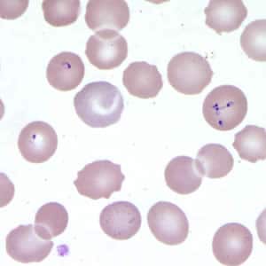 Figure D: <em>Babesia</em> sp. in a thin blood smear stained with Giemsa.