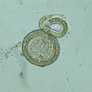 Figure A: Larva of <em>B. procyonis</em> hatching from an egg.