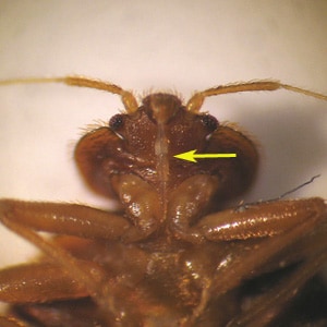 Figure E: Higher magnification of the specimen in Figure D, showing a close-up of the typical hemipteran piercing-sucking mouthparts (arrow).