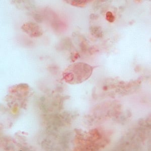 Figure C: Trophozoite of <em>C. mesnili</em> from a stool specimen, stained with trichrome. Image taken at 1000x magnification.