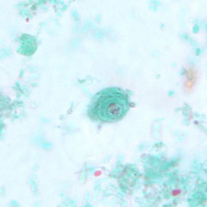 Figure D: Cyst of <em>C. mesnili</em> in a stool specimen, stained with trichrome. Image taken at 1000x magnification.