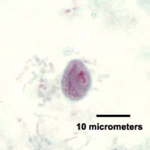 Figure E: Cyst of <em>C. mesnili</em> in a stool specimen, stained with trichrome. Image taken at 1000x magnification.