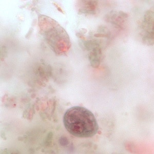 Figure F: Cyst (lower) and trophozoite (upper) of <em>C. mesnili</em> in a stool specimen, stained with trichrome. Image taken at 1000x magnification.
