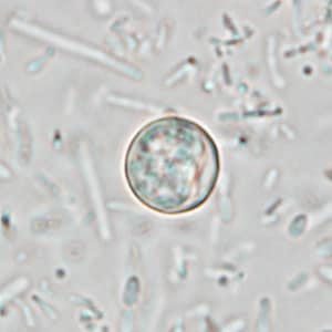 Figure D: Oocyst of <em>C. cayetanensis</em> in an unstained wet mount of stool. Image taken at 1000x magnification.
