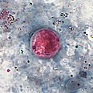 Figure B: Oocyst of <em>C. cayetanensis</em> stained with safranin (SAF).