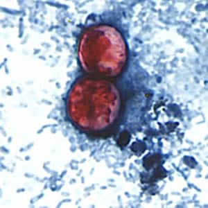 Figure E: A pair of oocysts of <em>C. cayetanensis</em> stained with safranin (SAF).