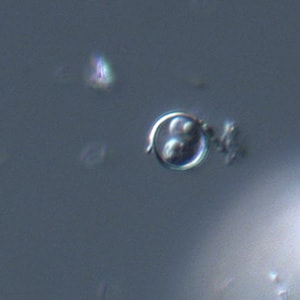 Figure C: Oocyst of <em>C. cayetanensis</em> viewed under DIC microscopy. There are two sporocysts are visible in this image.