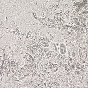 Figure A: Immature oocyst of <em>C. belli</em> in an unstained wet mount showing a single sporoblast.