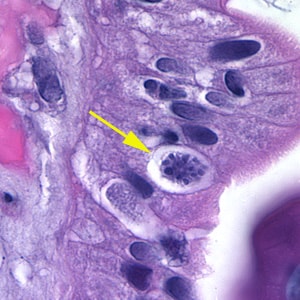 Figure B: Oocyst of <em>C. belli</em> in the epithelial cells of a mammalian host, stained with H&E (yellow arrow). 