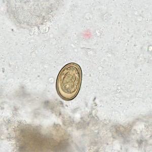 Figure C: Egg of <em>D. dendriticum</em> in an unstained wet mount of stool.