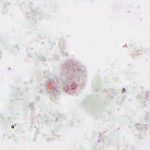 Figure A:Uninucleate form of a trophozoite of <em>D. fragilis</em>, stained with trichrome.