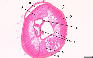 Figure B: Another section of <em>Dirofilaria tenuis</em> from a subcutaneous nodule. Many useful dirofilarine features are visible: large lateral chords (A); internal lateral ridge at the level of the lateral chords (B); multi-layered ridged cuticle (C); tall, coelomyrian musculature (D); small intestine (E); and paired reproductive tubules (F). 