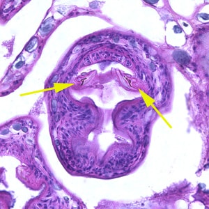Figure B: Higher magnification (400x) of the specimen in Figure A. Notice a pair of refractile hooks (yellow arrows). Cestode hooks do not stain with H&E but may be visible with proper adjustment of the microscope.