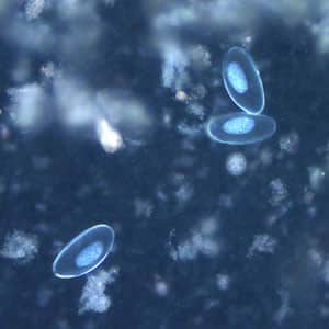 Figure E: Eggs of <em>E. vermicularis</em> viewed under UV microscopy.