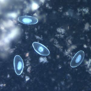 Figure F: Eggs of <em>E. vermicularis</em> viewed under UV microscopy.