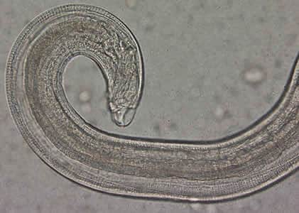 Figure C: Close-up of the posterior end of the worm in Figure A. Note the blunt end. The spicule is withdrawn into the worm in this specimen.