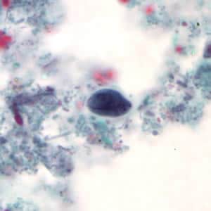 Figure A: <em>G. duodenalis</em> cyst stained with trichrome.