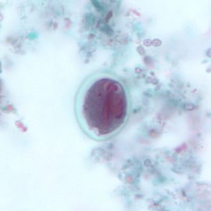 Figure G: <em>G. duodenalis</em> cyst stained with trichrome. Sometimes the cytoplasm of the cyst may retract from the cell wall.