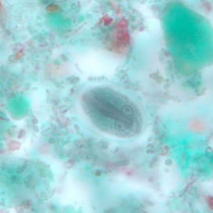 Figure I: <em>G. duodenalis</em> cyst stained with trichrome. Sometimes the cytoplasm of the cyst may retract from the cell wall.