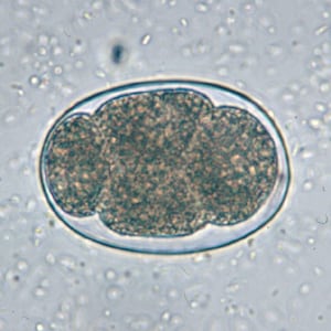 Figure D: Hookworm egg in an unstained wet mount.