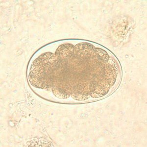 Figure B: Hookworm egg in an unstained wet mount, taken at 400x magnification.