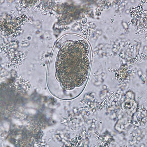 Figure C: Hookworm egg in an unstained wet mount.