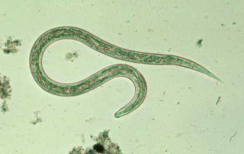 Figure C: Filariform (L3) hookworm larva in a wet mount.