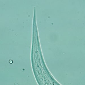 Figure D: Close-up of the posterior end of a filariform (L3) hookworm larva.