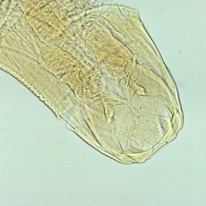 Figure A: Adult worm of <em>Ancylostoma duodenale</em>. Anterior end is depicted showing cutting teeth.