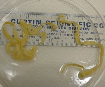 A 49-year-old female passed a worm-like object approximately three weeks after attending a Thanksgiving potluck for 200 people. Prior to the Thanksgiving meal, the patient had experienced diarrhea for two weeks.