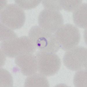 A 22-year-old man had a post-travel medical evaluation that included hematologic work-up after returning from an 11-day missionary trip to Honduras.  Blood was collected in EDTA at a medical center and thin smears were prepared and stained for examination.