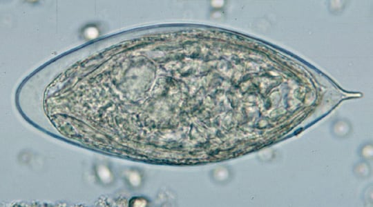  Eggs of S. haematobium in wet mounts of urine concentrates, showing the characteristic terminal spine.