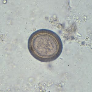 Taenia spp. eggs in unstained wet mounts. 