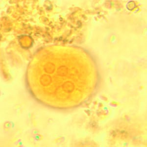 Figure D: Cyst of <em>E. coli</em> in a concentrated wet mount stained with iodine. Five nuclei are visible in this focal plane.