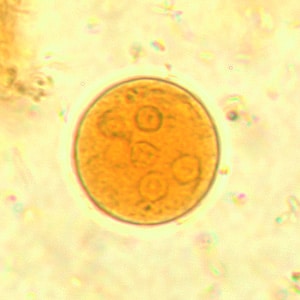 Figure C: Cyst of <em>E. coli</em> in a concentrated wet mount stained with iodine. Seven nuclei are visible in this focal plane.