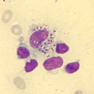Figure A: <em>Leishmania</em> sp. amastigotes in a Giemsa-stained tissue scraping.