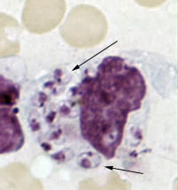 Figure C: <em>Leishmania tropica amastigotes</em> from an impression smear of a biopsy specimen from a skin lesion. In this figure, an intact macrophage is practically filled with amastigotes (arrows), several of which have a clearly visible nucleus and kinetoplast.