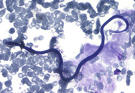 Figure D: Microfilaria of <em>L. loa</em> in a thin blood smear, stained with Giemsa.