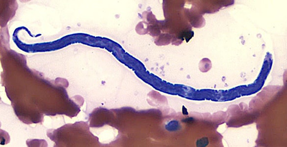 Figure F: Microfilaria of <em>L. loa</em> in a thin blood smear, stained with Giemsa.
